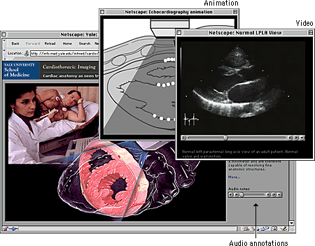Screen shot: Audio annotations, animation, and video on Cardiothoracic Imaging site